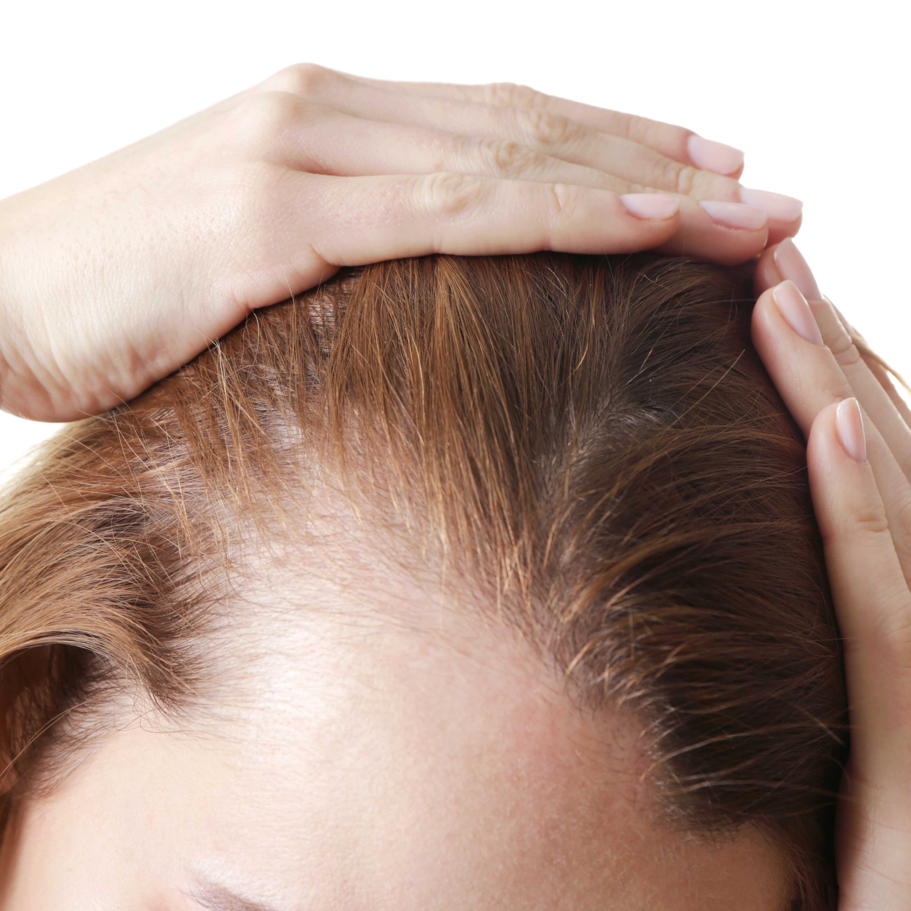 Causes Of Hair Loss In Women - Moore Unique Skin Care